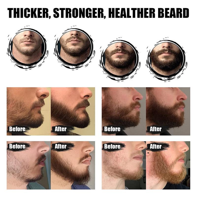 5pcs Men Beard Barba Grooming  - огляд і ціна Men'S Grooming Tonic